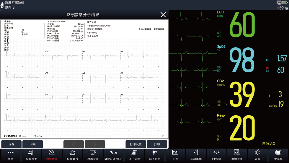 12導靜息心電分析